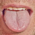 Jedno područje u ustima morate temeljno da čistite ako želite da izbegnete loš zadah