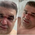 Saša Mirković operisan! Oglasio se nakon buđenja iz anestezije i otkrio detalje prebijanja: Dobio sam udarac u potiljak, a…