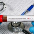 Novi način za lečenje raka prostate: Naučnici otkrili „slabu tačku“ tumora koja ga tera da se samouništi