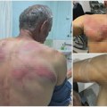 Srpska lista: Kosovska policija upala u kuću Nenada Raškovića, tukla ga, vezala za drvo i tražila da prizna ratni zločin FOTO…