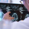 Tokom prelaska u menopauzu usporava se jedan proces u mozgu povezan sa starenjem, pokazuje studija