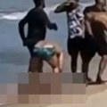 Užas na popularnoj plaži: Dečaku (11) ajkula otkinula nogu