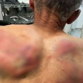"Ovo su bezbednosne pretnje" Vujinović o brutalnom napadu na Raškovića na KiM: Nije izolovani incident, Srbi na KiM ozbiljno…