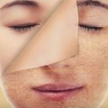 Najnoviji TikTok video otkriva makeup koji uzrokuje akne: Evo šta treba izbegavati!