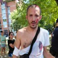Bojana su SNS batinaši brutalno pretukli na Limanu. Za Nova.rs otkriva: Prepoznao sam ljude iz Ćacilenda, iz policije mi rekli…