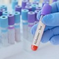 Novi test iz krvi mogao bi da predvidi rizik od Alchajmerove bolesti