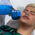 Nakon izlaska iz Elite 10 menja pol Uroš Stanić otišao na remont: Uvećao usne i jagodice, pa pozirao u ordinaciji (foto)