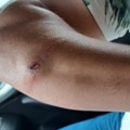 Izvukao muškarca iz automobila, pa ga prebio palicom: Brutalan napad u Priboju uoči odlaska na skup u Niš (foto)