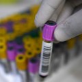 Bolnica korišćenjem špriceva više puta izazvala HIV epidemiju kod dece