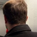 Jeziva pljačka preko pametnog sata: Muškarcu skinuli više od 5.000 evra u noćnom klubu, pre toga mu sipali drogu u piće