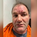 Član GG Ljudi u centru fizički napadnut, slučaj prijavljen policiji