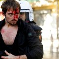 (Foto) Haos u Tirani i Albaniji: Studentski protesti prerasli u sukobe s policijom i napade Molotovljevim koktolima