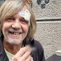 Bez prednjeg zuba i sa ranom na čelu, Žika Todorović objavio sliku i zabrinuo mnoge: "Posle nesporazuma..."