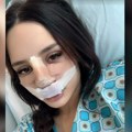 Nina Đogani operisala nos, objavila sliku sa zavojima na licu odmah nakon intervencije, svi u šoku (foto)