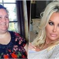 Natalija je smršala 80 kilograma i otišla kod plastičara: Na šok transformaciju uopšte nije potrošila toliko koliko se…
