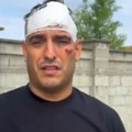 Darko Lazić vozio tuđi automobil Ogromna šteta na mercedesu, popravka će koštati bar 120.000 evra pevač izjavio da namerava da…