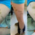 Dečaka vršnjak pretukao motkom na rekreativnoj nastavi na Divčibarama, on danima ćutao jer mu je pretio da će ga zaklati…
