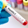 Hepatitis C – podmukao virus, ali i te kako izlečiv