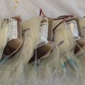 Ne meri se bolom, već dobrim delom – dobrovoljnim davanjem krvi možete spasiti nečiji život