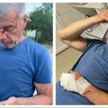 Novi napad na Srbe: Branio je sina, a Albanci ga pretukli! Krvav je završio u bolnici