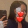 "Živa sam..." Bivšoj zadrugarki uklonjen tumor iz glave, evo u kakvom je stanju nakon teške operacije (foto)