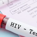 U susret svetskom danu borbe protiv hiva Svi građani mogu 1. decembra da se besplatno testiraju na ovom mestu!