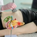 Koje metode su najbolje za pregled pankreasa? Evo kada je dovoljan ultrazvuk, a kada su potrebni skener ili magnetna rezonanca