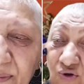 Ne smem da se pogledam u ogledalo, opale su mi trepavice Rada Vasić otkrila potresne detalje borbe protiv opake bolesti