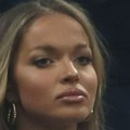 "Pojavilo mi se od stresa": Teodora Džehverović otkrila sa kakvim se zdravstvenim problemom bori