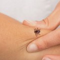 Koliko dugo krpelj mora da bude pričvršćen za kožu da biste se zarazili?