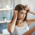 Osetljiva koža glave: Šta je uzrokuje i kako da je negujete?