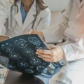 Pet simptoma moždanog udara - znak da treba odmah pozvati Hitnu pomoć
