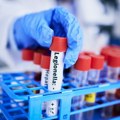 Epidemija opasne bolesti hara Njujorkom: Preminula još jedna osoba