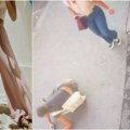 Zarine pantalone postale viralne zbog žena koje su se povredile, ali nisu prvi komad zbog kog žene stradaju