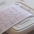 Besplatni preventivni pregledi bez zakazivanja u UKC Kragujevac