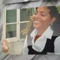 Kristina je mislila da je samo pod stresom zbog razvoda: A onda su joj prsti pobeleli i zubi počeli da joj ispadaju
