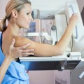 "Batut" organizuje besplatnu mamografiju: Pregled mogu uraditi žene starosti od 45 do 69 godina