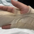 "Plaši se, kaže da su mu pretili da će da ga ubiju": Oglasila se majka dečaka (14) kojeg su brutalno pretukli vršnjaci…