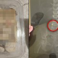(Foto) dete jelo vanilice pa progutalo bateriju! Otac iz Bora objavio dramatičan rendgen snimak i opisao celu agoniju…