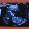 Na Floridi stupila na snagu zabrana abortusa nakon šeste nedelje trudnoće