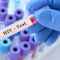 Alarm svetskih stručnjaka: Zabrinjavajuća nestašica ključnih lekova za HIV