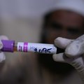 U Dušanbeu uhapšeno 10 osoba, namerno zarazili HIV-om 60 ljudi