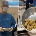 Svakog dana je pio 3 litra pića koje svi masovno konzumiramo, a onda su mu ovo izvadili iz bubrega i bešike: Dobro ćete se…