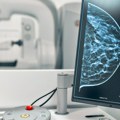 Mobilni mamograf u Velikom Gradištu od utorka: Zašto je važno da se žene redovno pregledaju