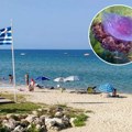 Devojčica (4) je Vrištala od bolova! Drama na plaži u Grčkoj, jednu stvar ne smete da radite ako vas napadne meduza