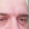 Bojan Tomović zadobio ozbiljnu povredu glave: Odmah ga odvezli u bolnicu, ovo je prva slika