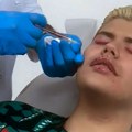 Uroš Stanić otišao na remont pa uvećao jagodice i usne: Planira da menja pol nakon izlaska iz "Elite 10"