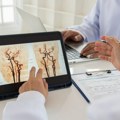 Koji su simptomi moždanog krvarenja – zašto je ono fatalno?