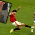 Ostala mu rupa na nozi, a sudija uopšte nije reagovao! Fudbaler pokazao povredu nakon brutalnog starta igrača Mančester…