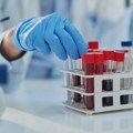 Institut za transfuziju krvi pozvao građane da daju krv